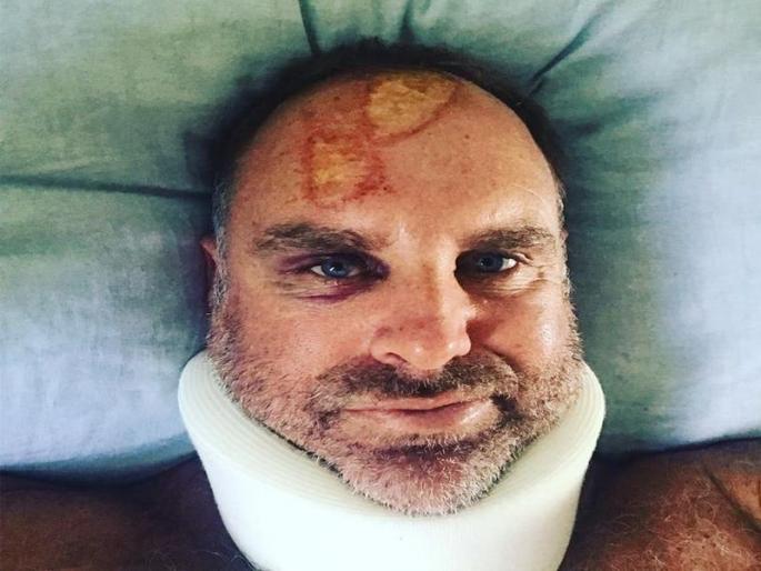 Former Australian batsman Matthew Hayden fractures neck in surfing accident | आॅस्ट्रेलियाचा माजी फलंदाज मॅथ्यू हेडनला सर्फिंग करताना गंभीर अपघात