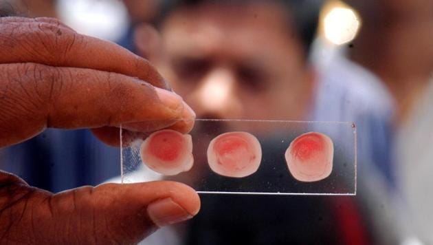 Two rare blood group 'Parabombe O Positive' found for the first time in Nagpur | नागपुरात पहिल्यांदाच आढळल्या 'पॅराबॉम्बे ओ पॉझिटिव्ह' या दुर्मिळ रक्तगटाच्या दोन व्यक्ती Two rare blood group 'Parabombe O Positive' found for the first time in Nagpur | नागपुरात पहिल्यांदाच आढळल्या 'पॅराबॉम्बे ओ पॉझिटिव्ह' या दुर्मिळ रक्तगटाच्या दोन व्यक्ती