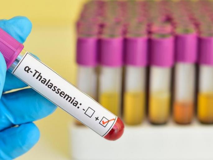 Akola GMC does not have medicines for thalassemia patients! | थॅलेसीमिया रुग्णांसाठी ‘जीएमसी’त औषधेच नाहीत!