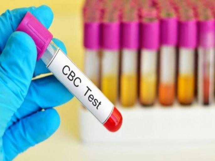 Corona Cases in Washim: 10 more killed; 578 positive | Corona Cases in Washim : आणखी १० जणांचा मृत्यू; ५७८ पॉझिटिव्ह Corona Cases in Washim: 10 more killed; 578 positive | Corona Cases in Washim : आणखी १० जणांचा मृत्यू; ५७८ पॉझिटिव्ह