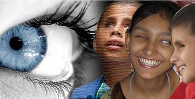 World Eye Donation Day; Eclipse of the corona for cataract surgery | जागतिक नेत्रदान दिवस; मोतीबिंदू शस्त्रक्रियेला कोरोनाचे ग्रहण