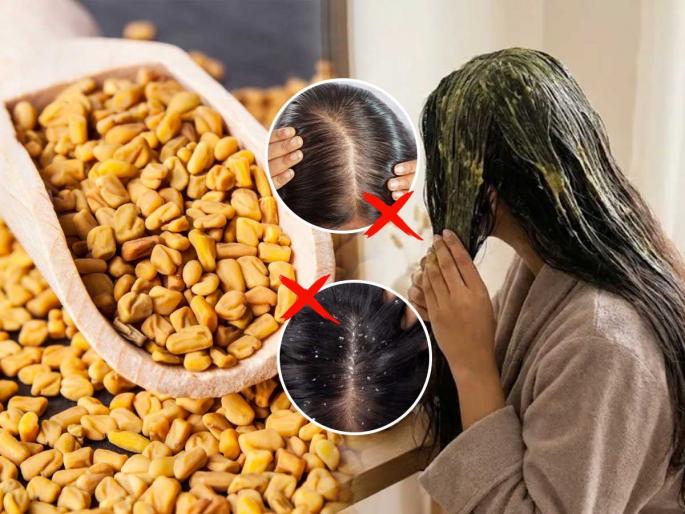 fenugreek seeds Best hair mask for severe dandruff How to remove dandruff naturally at home Weekly hair mask for clean scalp Natural remedy for itchy flaky scalp Hair mask for dandruff and hair growth | केसात भरपूर कोंडा- खराट्यासारख्या झाले? आठवड्यातून १ वेळा 'हा' हेअर मास्क लावा- टाळू होईल स्वच्छ- वाढतील जोमाने fenugreek seeds Best hair mask for severe dandruff How to remove dandruff naturally at home Weekly hair mask for clean scalp Natural remedy for itchy flaky scalp Hair mask for dandruff and hair growth | केसात भरपूर कोंडा- खराट्यासारख्या झाले? आठवड्यातून १ वेळा 'हा' हेअर मास्क लावा- टाळू होईल स्वच्छ- वाढतील जोमाने