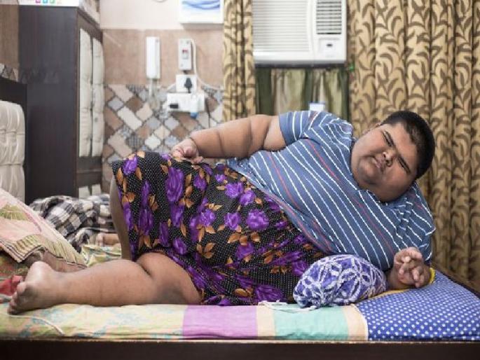 Doctors operate on 237kg Delhi boy, world's heaviest teen | २३७ किलो ते १७७ किलो... जगातील सर्वात लठ्ठ मुलावर दिल्लीत सर्जरी Doctors operate on 237kg Delhi boy, world's heaviest teen | २३७ किलो ते १७७ किलो... जगातील सर्वात लठ्ठ मुलावर दिल्लीत सर्जरी