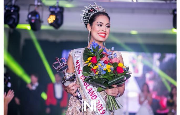 coronavirus : Miss England hangs up her crown & Ireland prime minister ragister himself to work as a doctor. | coronavirus : मिस इंग्लंड आणि आर्यलंडचे पंतप्रधान दोघांनी ठरवलं, आपण पुन्हा ‘डॉक्टर’ व्हायचं! coronavirus : Miss England hangs up her crown & Ireland prime minister ragister himself to work as a doctor. | coronavirus : मिस इंग्लंड आणि आर्यलंडचे पंतप्रधान दोघांनी ठरवलं, आपण पुन्हा ‘डॉक्टर’ व्हायचं!