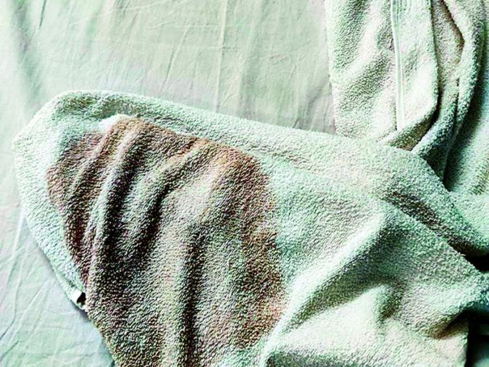 The rooms of the separation room in MLA residence of Nagpur are unclean | नागपूरच्या आमदार निवासातील विलगीकरण कक्षाच्या खोल्या अस्वच्छ The rooms of the separation room in MLA residence of Nagpur are unclean | नागपूरच्या आमदार निवासातील विलगीकरण कक्षाच्या खोल्या अस्वच्छ