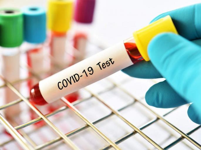 With the increase in tests, the number of positive patients has also increased, the positivity rate is also changing! | चाचण्या वाढल्याने पॉझिटिव्ह रुग्णांची संख्याही वाढली, पॉझिटिव्हिटी दरही बदलतोय! With the increase in tests, the number of positive patients has also increased, the positivity rate is also changing! | चाचण्या वाढल्याने पॉझिटिव्ह रुग्णांची संख्याही वाढली, पॉझिटिव्हिटी दरही बदलतोय!
