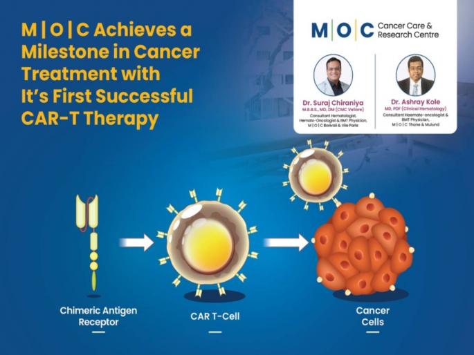 moc cancer care and research center reaches new milestone in cancer treatment achievement of the first successful car t therapy | कॅन्सर केअर आणि रिसर्च सेंटरने कॅन्सर उपचारात नवा मैलाचा दगड गाठला; पहिल्या यशस्वी CAR-T थेरपीची उपलब्धी moc cancer care and research center reaches new milestone in cancer treatment achievement of the first successful car t therapy | कॅन्सर केअर आणि रिसर्च सेंटरने कॅन्सर उपचारात नवा मैलाचा दगड गाठला; पहिल्या यशस्वी CAR-T थेरपीची उपलब्धी