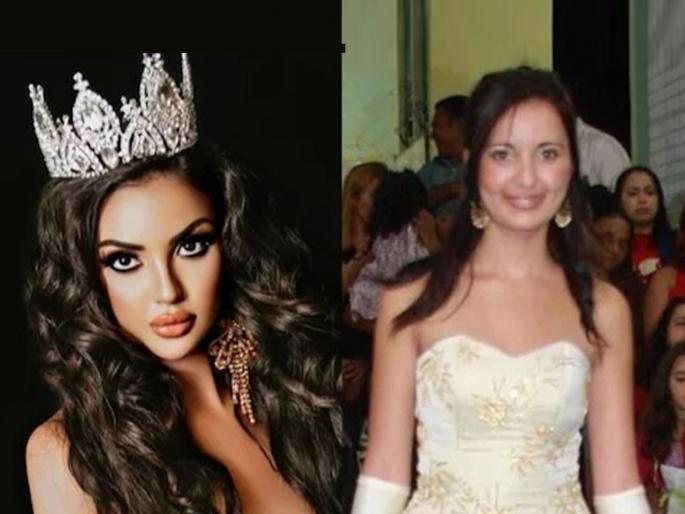 Model who wanted to look like Kim Kardashian is now ‘de-transitioning | किम कार्दिशयानसारखी दिसण्यासाठी तिने ४ कोटी खर्चून केल्या ४० सर्जरी! आता पस्तावतेय Model who wanted to look like Kim Kardashian is now ‘de-transitioning | किम कार्दिशयानसारखी दिसण्यासाठी तिने ४ कोटी खर्चून केल्या ४० सर्जरी! आता पस्तावतेय