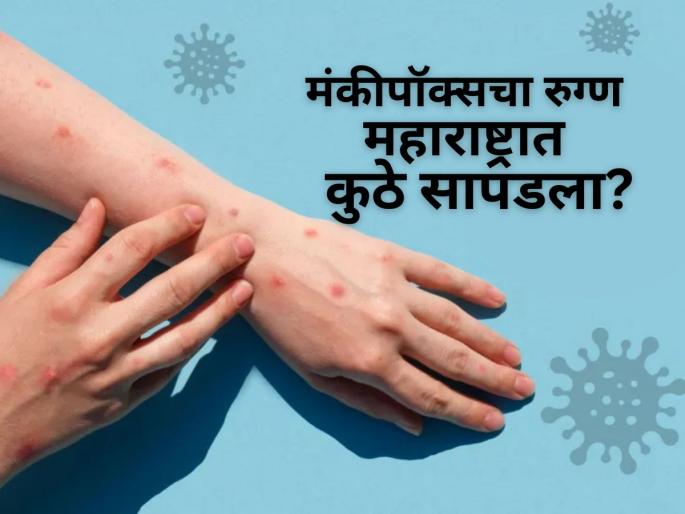 Maharashtra on Alert: State Reports First Monkeypox Case in Dhule; Patient Returned from Saudi Arabia. | राज्यासमोर मोठं संकट! जगभरात थैमान घालणाऱ्या आजाराचा पहिला रुग्ण सापडल्याने खळबळ