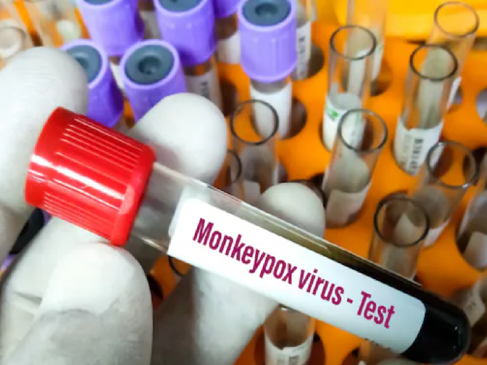 First case in the world; A 36-year-old man infected with Corona, monkeypox and HIV at the same time | जगातील पहिले प्रकरण; 36 वर्षीय व्यक्तीला एकाच वेळी कोरोना, मंकीपॉक्स आणि HIVची लागण...