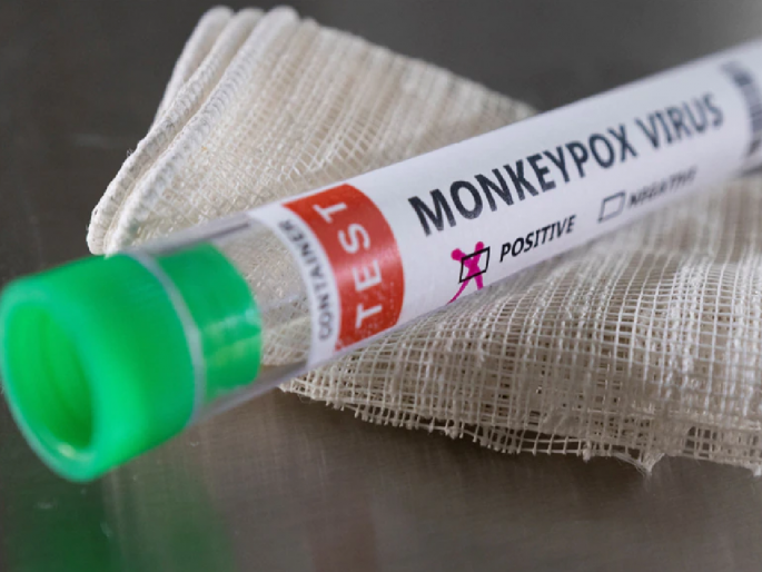 monkeypox like symptoms in a girl in Ghaziabad | गाझियाबादमध्ये मुलीला मंकीपाॅक्ससदृश लक्षणे, रक्ताचे नमुने तपासणीसाठी पाठविले