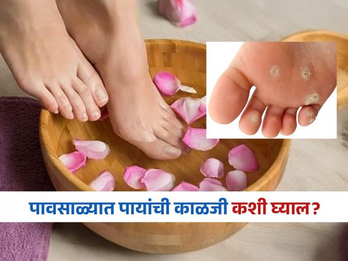 How do you prevent foot infection in rainy season? | पावसाळ्यात अधिक घ्या पायांची काळजी, इन्फेक्शनपासून बचावासाठी फॉलो करा सोप्या टिप्स!
