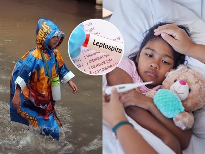 Monsoon health tips Infectious leptospirosis disease alert Dirty water infection know the symptoms | पावसाळ्यात साचलेल्या घाण पाण्यात जपून चाला, पसरतोय गंभीर संसर्गजन्य आजार- जीवावर बेतेल