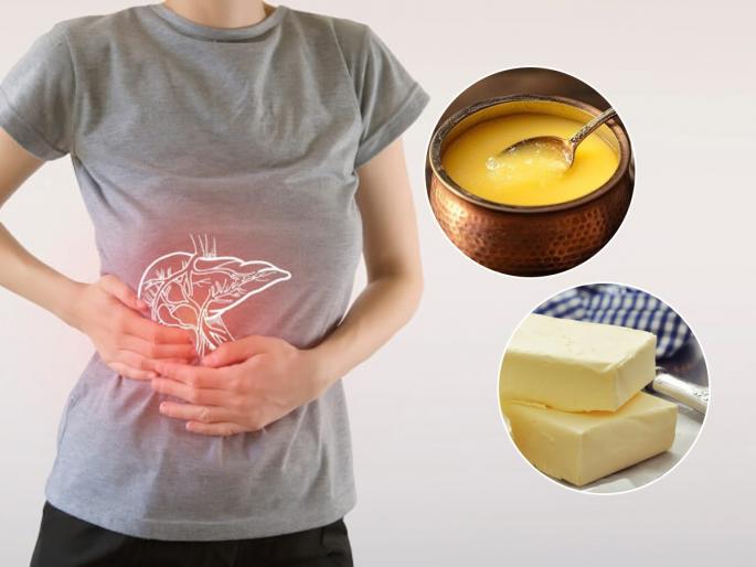 most dangerous food for liver, how to get rid of fatty liver, reasons and causes of fatty liver | तेल, तूप नाही; 'या' गोष्टी आहेत लिव्हरसाठी सगळ्यात जास्त घातक, फॅटी लिव्हरचा त्रास टाळण्यासाठी....
