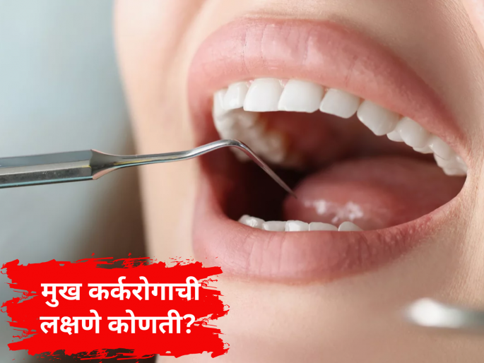 Mouth Cancer Day: Identify the risk of mouth cancer in time | Mouth Cancer Day: वेळीच ओळखा मुख कर्करोगाचा धोका, कारणे काय? Mouth Cancer Day: Identify the risk of mouth cancer in time | Mouth Cancer Day: वेळीच ओळखा मुख कर्करोगाचा धोका, कारणे काय?