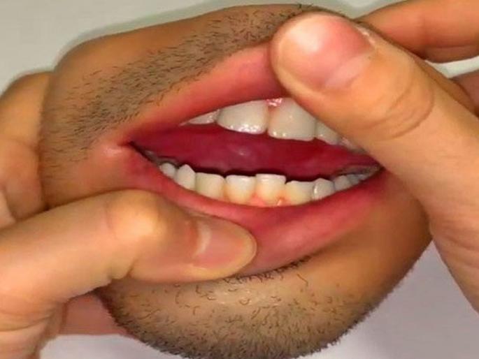 Human mouth shaped purse will make you shock goes viral over internet | बाबो! पुरूषाच्या तोंडाच्या आकाराची पर्स, व्हिडीओ पाहून घाबरलेत लोक!