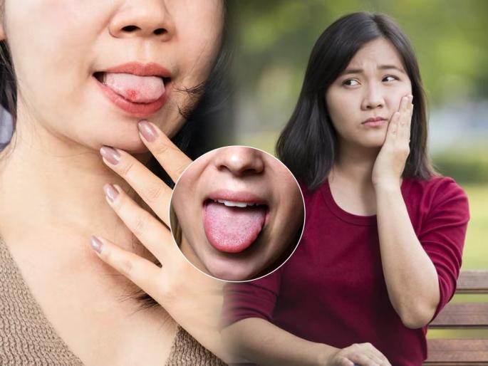 Ayurvedic remedy for mouth ulcers natural treatment for oral ulcers how to heal mouth ulcers fast pain relief tips | सतत तोंड येतं, फोडांमुळे खाण्याचे हाल? सोपा आयुर्वेदिक उपाय- तोंडाचा अल्सर होईल बरा, मिळेल आराम