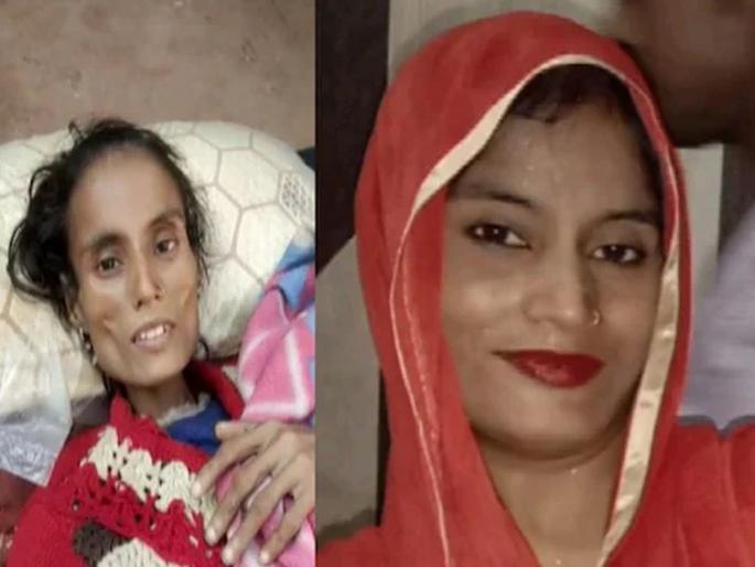 gwalior husband tortures wife hostage for four years suffering from the last stage of tb | धक्कादायक! पतीनं पत्नीला ४ वर्ष खोलीत डांबलं; प्रचंड अत्याचारामुळे झाली अशी अवस्था gwalior husband tortures wife hostage for four years suffering from the last stage of tb | धक्कादायक! पतीनं पत्नीला ४ वर्ष खोलीत डांबलं; प्रचंड अत्याचारामुळे झाली अशी अवस्था