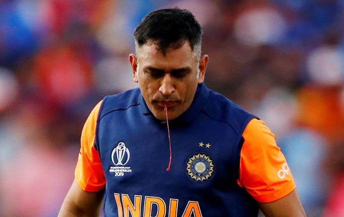 Mahendra Singh Dhoni has been away from the team because of his 'injury' | महेंद्रसिंग धोनी 'या' दुखापतीमुळे राहतोय संघापासून लांब