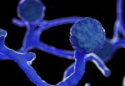 Patients with mucaremycosis infarction are also recovering | नागपुरात म्युकरमायकोसिसचे रुग्णही होत आहेत बरे Patients with mucaremycosis infarction are also recovering | नागपुरात म्युकरमायकोसिसचे रुग्णही होत आहेत बरे