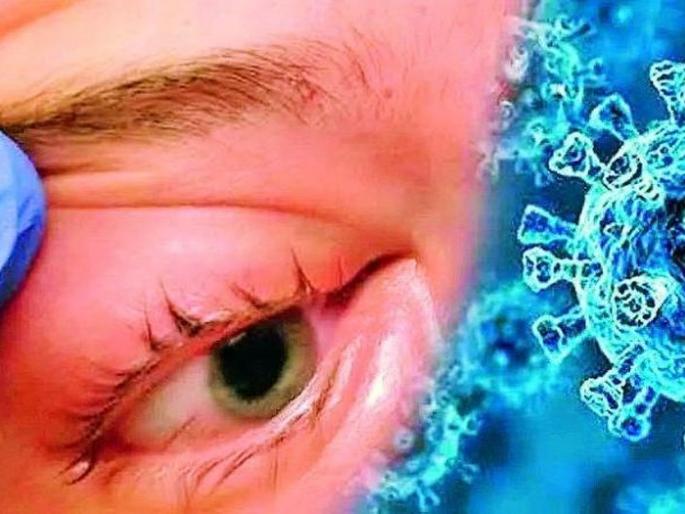 Mucomycosis on the way back; No one's eye is useless | म्युकरमायकोसिस परतीच्या मार्गाला; एकाचाही डोळा निकामी नाही