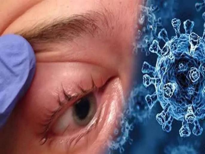 18 patients with mucomycosis in the city: Corona infection in children | नगरमध्ये म्युकरमायकोसिसचे १८ रुग्ण : लहान मुलांनाही कोरोनाची बाधा