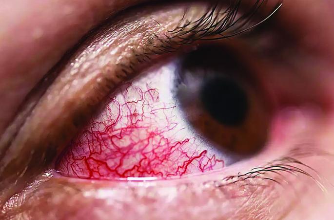 A gang Fraud mucormycosis Medicines in Pimpri-Chinchwad | Medicine Fraud! पिंपरीत म्युकरमायकोसिसच्या औषधांचा काळा बाजार करणाऱ्या टोळीचा पर्दाफाश A gang Fraud mucormycosis Medicines in Pimpri-Chinchwad | Medicine Fraud! पिंपरीत म्युकरमायकोसिसच्या औषधांचा काळा बाजार करणाऱ्या टोळीचा पर्दाफाश