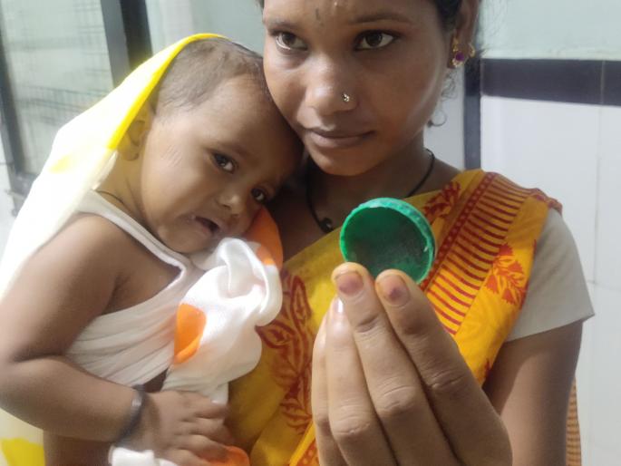 The doctor removed the box stuck in the neck and gave life to the child | गळ्यात अडकलेली डबी डॉक्टरांनी अलगद काढून बालकाला दिले जीवनदान