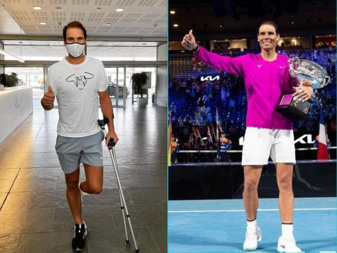 Rafael Nadal: Defeating his own sore knees ... he finally won !! | Rafael Nadal: स्वत:च्याच दुखऱ्या गुडघ्यांना हरवून... अखेर तो जिंकला !! Rafael Nadal: Defeating his own sore knees ... he finally won !! | Rafael Nadal: स्वत:च्याच दुखऱ्या गुडघ्यांना हरवून... अखेर तो जिंकला !!