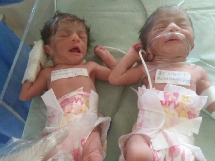 CoronaVirus News in Ahmednagar: Corona positive woman gives birth to twins rkp | CoronaVirus News in Ahmednagar : कोरोना पॉझिटिव्ह महिलेने दिला जुळ्या बाळांना जन्म