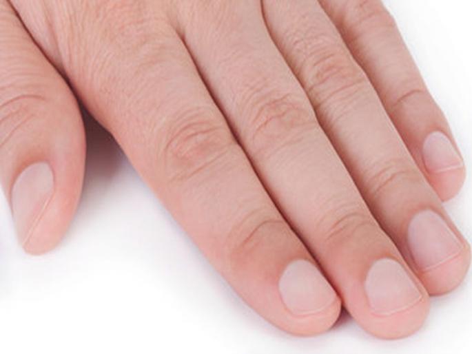 New smartphone app uses fingernail photos to screen for anaemia | आता तुमचं नख सांगणार शरीरातील रक्ताचं प्रमाण; लवकरच येणार खास अॅप New smartphone app uses fingernail photos to screen for anaemia | आता तुमचं नख सांगणार शरीरातील रक्ताचं प्रमाण; लवकरच येणार खास अॅप