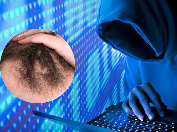 Oil became expensive online! Son's hair loss in America, Vashi's father loses millions | ऑनलाइन तेल पडले महागात! अमेरिकेत मुलाची केस गळती, वाशीतल्या वडिलांना लाखोंचा गंडा