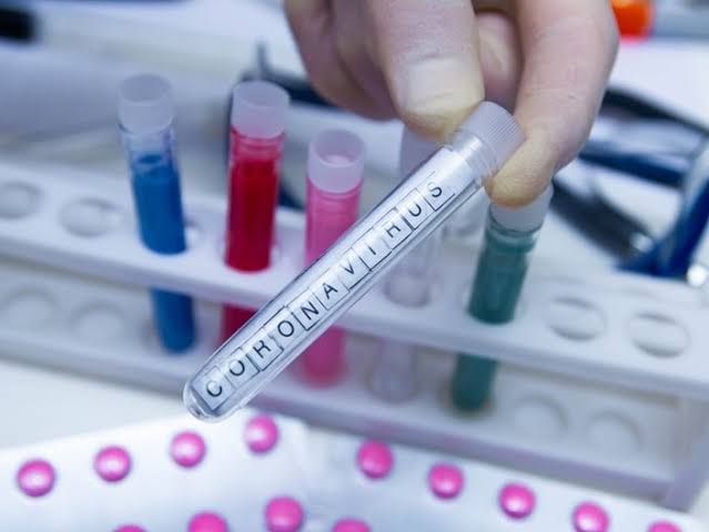 Coronavirus in Buldhana: 11 reported negative in Shegaon, Khamgaon | Coronavirus in Buldhana : शेगाव, खामगावातील ११ जणांचे अहवाल निगेटीव्ह Coronavirus in Buldhana: 11 reported negative in Shegaon, Khamgaon | Coronavirus in Buldhana : शेगाव, खामगावातील ११ जणांचे अहवाल निगेटीव्ह