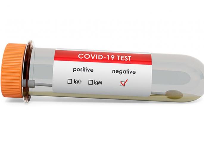 Coronavirus in Akola: As many as 402 negative reports; 21 Positive | CoronaVirus in Akola : तब्बल ४०२ अहवाल निगेटिव्ह; २१ पॉझिटिव्ह Coronavirus in Akola: As many as 402 negative reports; 21 Positive | CoronaVirus in Akola : तब्बल ४०२ अहवाल निगेटिव्ह; २१ पॉझिटिव्ह