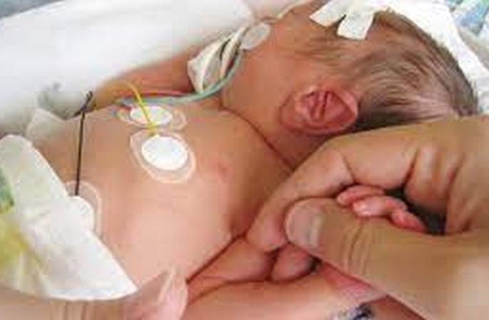 Birth defects in newborns are being discovered through DIC! | ‘डीआयसी’मार्फत शोधले जाताहेत नवजात शिशूंमधील जन्मत:च दोष! Birth defects in newborns are being discovered through DIC! | ‘डीआयसी’मार्फत शोधले जाताहेत नवजात शिशूंमधील जन्मत:च दोष!