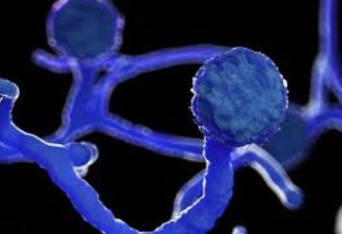 There are 439 patients with mucaremycosis in 89 hospitals in Nagpur | नागपुरात ८९ रुग्णालयांमध्ये म्युकरमायकोसिसचे ४३९ रुग्ण There are 439 patients with mucaremycosis in 89 hospitals in Nagpur | नागपुरात ८९ रुग्णालयांमध्ये म्युकरमायकोसिसचे ४३९ रुग्ण