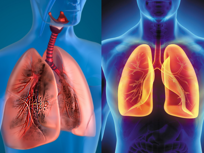 Home remedies include herbs and food in your diet to strong your lungs myb | कोरोनाला दूर ठेवण्याासह फुफ्फुसांच्या इन्फेक्शनपासून लांब राहण्यासाठी करा 'हे' उपाय Home remedies include herbs and food in your diet to strong your lungs myb | कोरोनाला दूर ठेवण्याासह फुफ्फुसांच्या इन्फेक्शनपासून लांब राहण्यासाठी करा 'हे' उपाय