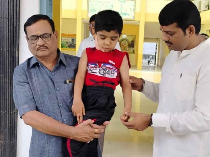 A five-year-old boy was attacked by a stray dog | पाच वर्षाच्या मुलावर मोकाट कुत्र्याचा हल्ला A five-year-old boy was attacked by a stray dog | पाच वर्षाच्या मुलावर मोकाट कुत्र्याचा हल्ला