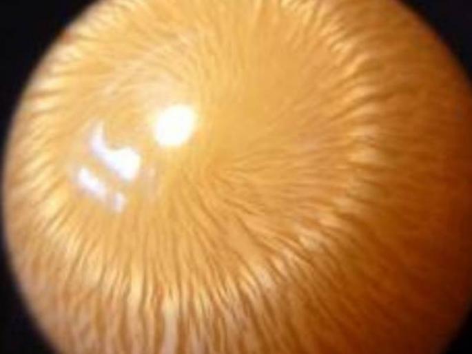 thailand truck driver finds rare orange pearl worth crores inside a sea snail during lunch | जेवण करता करता ट्रक ड्रायव्हरचं नशीब पालटलं, १०० रुपयांत झाला कोट्यवधींचा मालक! thailand truck driver finds rare orange pearl worth crores inside a sea snail during lunch | जेवण करता करता ट्रक ड्रायव्हरचं नशीब पालटलं, १०० रुपयांत झाला कोट्यवधींचा मालक!