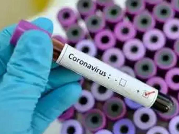 Three killed, 321 corona positive in Akola district | अकोला जिल्ह्यात तिघांचा मृत्यू, ३२१ जण कोरोना पॉझिटिव्ह Three killed, 321 corona positive in Akola district | अकोला जिल्ह्यात तिघांचा मृत्यू, ३२१ जण कोरोना पॉझिटिव्ह