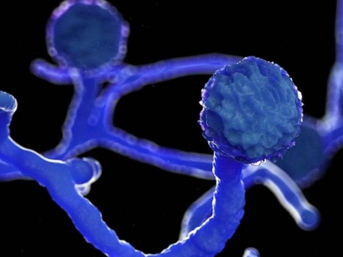 9 patients with mucomycosis in Mira Bhayander Discharge given to 2 patients | मीरा भाईंदर मध्ये म्युकरमायकोसिसचे ९ रुग्ण ; २ रुग्णांना दिला डिस्चार्ज 9 patients with mucomycosis in Mira Bhayander Discharge given to 2 patients | मीरा भाईंदर मध्ये म्युकरमायकोसिसचे ९ रुग्ण ; २ रुग्णांना दिला डिस्चार्ज