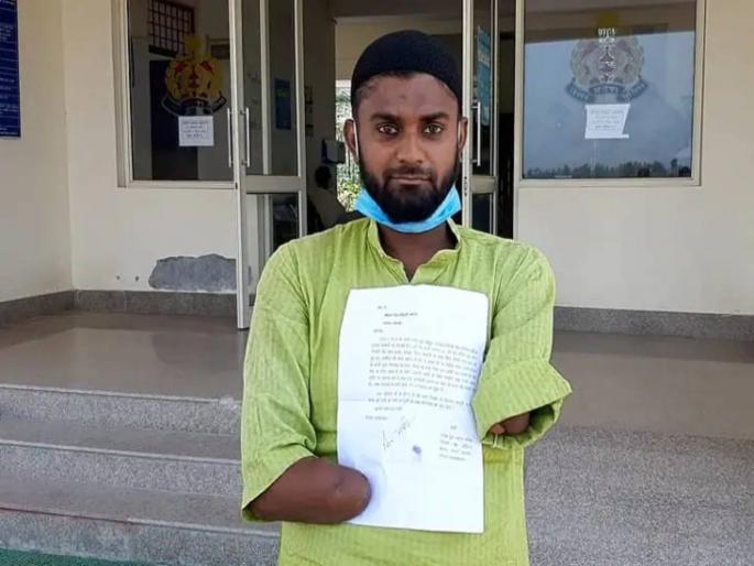 husband caught eleven thousand high voltage wire for wife lost both hands in uttar pradesh | पत्नीच्या प्रेमात वेडावलेल्या पतीनं धरली ११ हजार हाय व्होल्टेज विजेची तार; दोन्ही हात गमावले husband caught eleven thousand high voltage wire for wife lost both hands in uttar pradesh | पत्नीच्या प्रेमात वेडावलेल्या पतीनं धरली ११ हजार हाय व्होल्टेज विजेची तार; दोन्ही हात गमावले