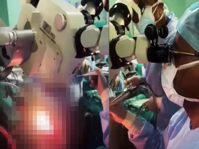 girl chanting hunuman chalisa during brain tumor surgery watch viral video | VIDEO: ऑपरेशन टेबलवर तरुणी पठण करत होती हनुमान चालिसा; डॉक्टरांनी केली यशस्वी ब्रेन सर्जरी girl chanting hunuman chalisa during brain tumor surgery watch viral video | VIDEO: ऑपरेशन टेबलवर तरुणी पठण करत होती हनुमान चालिसा; डॉक्टरांनी केली यशस्वी ब्रेन सर्जरी