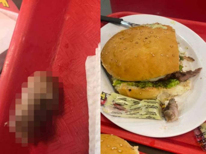 Customer finds human finger in burger she was served at an eatery | धक्कादायक! रेस्टॉरंटमध्ये महिलेनं मागवला बर्गर; पहिल्याच घासात सापडलं माणसाचं बोट Customer finds human finger in burger she was served at an eatery | धक्कादायक! रेस्टॉरंटमध्ये महिलेनं मागवला बर्गर; पहिल्याच घासात सापडलं माणसाचं बोट