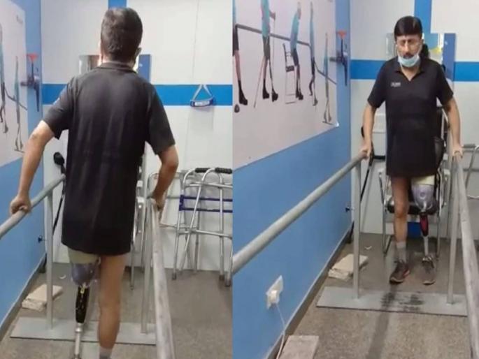 CoronaVirus News patient lost one of his legs due to coronavirus infection | CoronaVirus News: कोरोना रुग्णाची बिकट अवस्था; जीव वाचवण्यासाठी पाय कापावा लागला CoronaVirus News patient lost one of his legs due to coronavirus infection | CoronaVirus News: कोरोना रुग्णाची बिकट अवस्था; जीव वाचवण्यासाठी पाय कापावा लागला