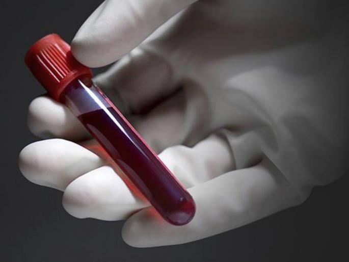 15 days blood stock balance in the state Blood shortage due to increased stress of noncovid services | राज्यात १५ दिवसांचा रक्तसाठा शिल्लक; नाॅनकोविड सेवांचा ताण वाढल्याने रक्त तुटवडा 15 days blood stock balance in the state Blood shortage due to increased stress of noncovid services | राज्यात १५ दिवसांचा रक्तसाठा शिल्लक; नाॅनकोविड सेवांचा ताण वाढल्याने रक्त तुटवडा