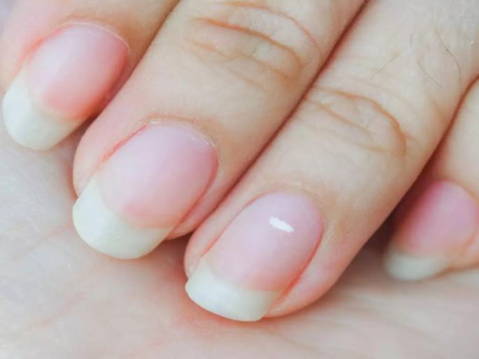 According to oceanography, white spots on nails are good; Learn how it may predict about prosperity? Read! | समुद्रशास्त्रानुसार नखांवरील पांढरे 'दाग अच्छे है'; ते धन समृद्धीचे लक्षण कसे? जाणून घ्या! According to oceanography, white spots on nails are good; Learn how it may predict about prosperity? Read! | समुद्रशास्त्रानुसार नखांवरील पांढरे 'दाग अच्छे है'; ते धन समृद्धीचे लक्षण कसे? जाणून घ्या!