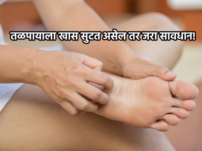 Samudra Shastra: Itchy soles are not a good omen; Oceanography says... | Samudra Shastra: तळपायाला खाज सुटणे काही चांगले लक्षण नाही; समुद्र शास्त्र सांगते... Samudra Shastra: Itchy soles are not a good omen; Oceanography says... | Samudra Shastra: तळपायाला खाज सुटणे काही चांगले लक्षण नाही; समुद्र शास्त्र सांगते...