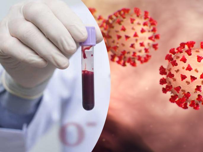 Corona Virus : People with blood type A might be more susceptible to coronavirus, study finds api | Corona Virus : 'या' Blood group च्या लोकांना कोरोना व्हायरसचा अधिक धोका, रिसर्चमधून खुलासा Corona Virus : People with blood type A might be more susceptible to coronavirus, study finds api | Corona Virus : 'या' Blood group च्या लोकांना कोरोना व्हायरसचा अधिक धोका, रिसर्चमधून खुलासा