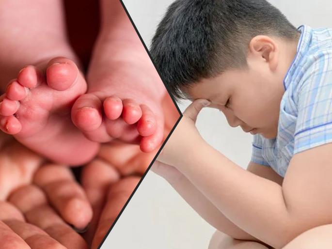 Study says child born with cesarean delivery does not develop obesity | सिजेरियनने जन्मलेल्या मुलांमध्ये खरंच लठ्ठपणा वाढतो का? Study says child born with cesarean delivery does not develop obesity | सिजेरियनने जन्मलेल्या मुलांमध्ये खरंच लठ्ठपणा वाढतो का?